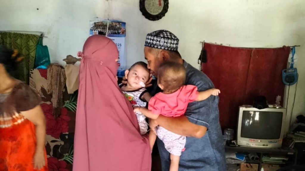 Minum Asi Menggunakan Selang Lewat Hidung, Bantu Pengobatan Adik Kembar