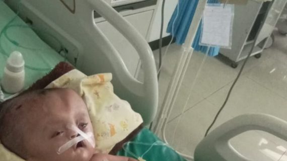 Adik Azka Masih Berjuang Sembuh dari Hidrosefalus